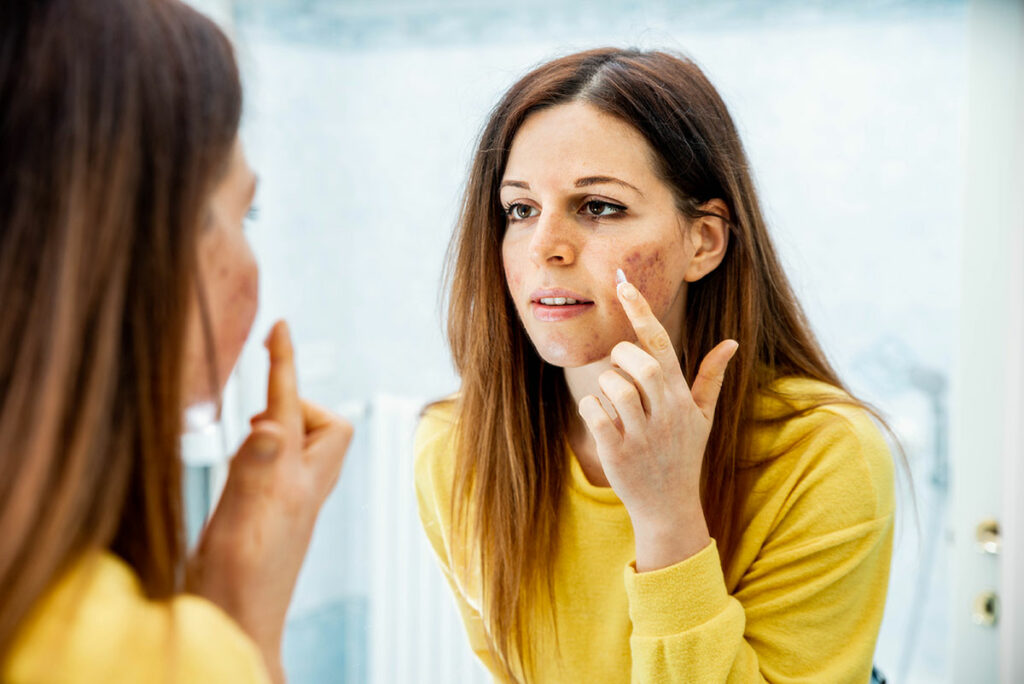 skin infection treatment online