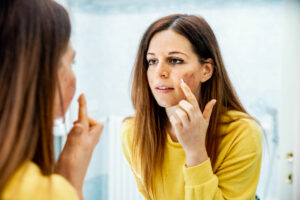 skin infection treatment online